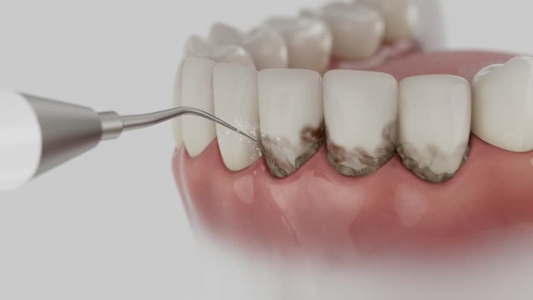 Reliable Dental Implants contractor in Southport, CT by Smile Center Dentistry